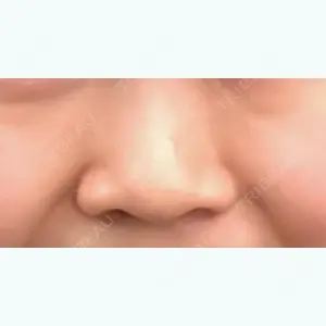 TCB東京中央美容外科 TCB東京中央美容外科 渋谷西口院口コミ