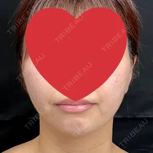 藤・ナチュレ美容クリニック 藤・ナチュレ美容クリニック 銀座院口コミ