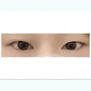 before image