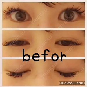 before image