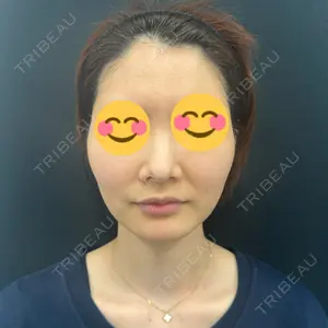 東京シンデレラ美容外科の口コミ