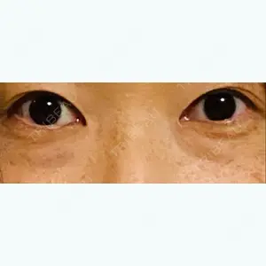 東京美容外科 東京美容外科 青森院口コミ