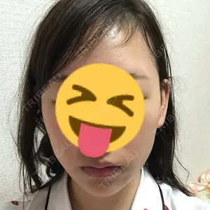 before image