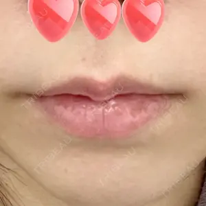 東京シンデレラ美容外科の口コミ