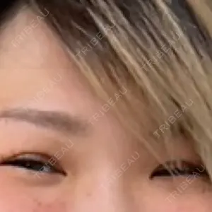 TCB東京中央美容外科 町田院の山崎 智徳医師口コミ
