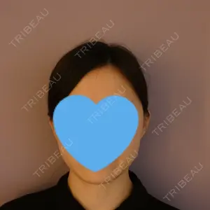 before image