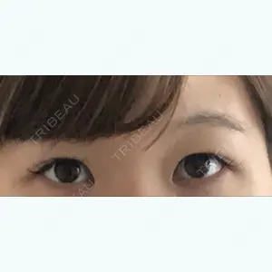 before image