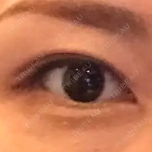 before image