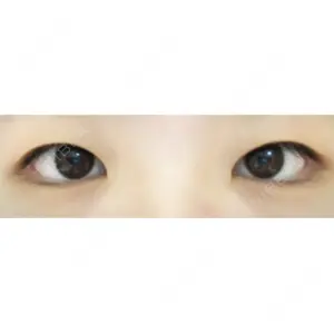 before image