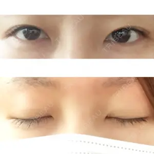 before image