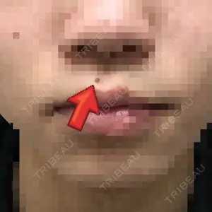 before image