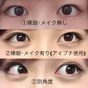 before image