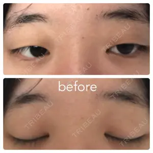 before image