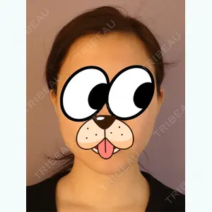 before image