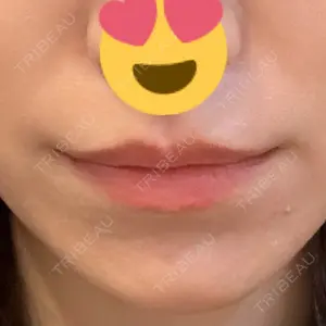 渋谷美容外科クリニック 新橋院の藏薗 侑人医師口コミ