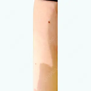 Fellez Clinic【フェルズクリニック】の小野 泰寛医師口コミ