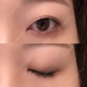 before image