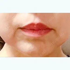 渋谷美容外科クリニック 渋谷院の藏薗 侑人医師口コミ