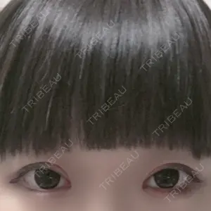 before image