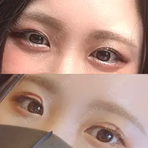 TCB東京中央美容外科 TCB東京中央美容外科 名古屋栄院口コミ