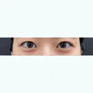 口コミ