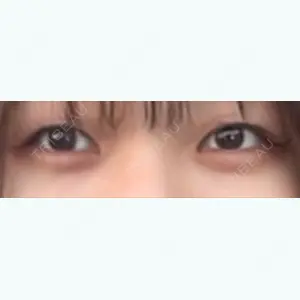 口コミ
