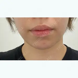 TCB東京中央美容外科 TCB東京中央美容外科 仙台駅前院口コミ