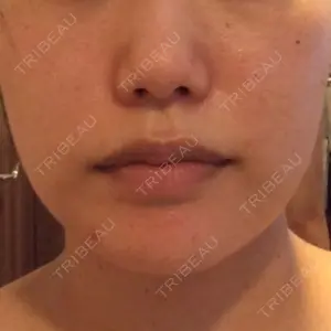 TCB東京中央美容外科 TCB東京中央美容外科 大宮東口院口コミ
