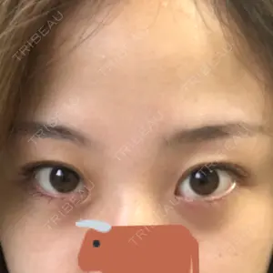 before image