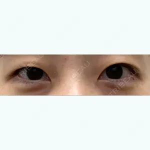 湘南美容クリニック 湘南美容クリニック 池袋東口院口コミ