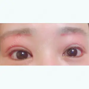 before image