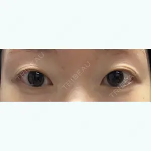 湘南美容クリニック 湘南美容クリニック 池袋東口院口コミ