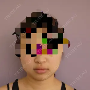 before image