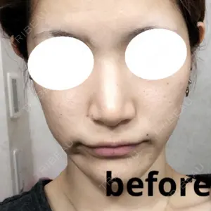 before image