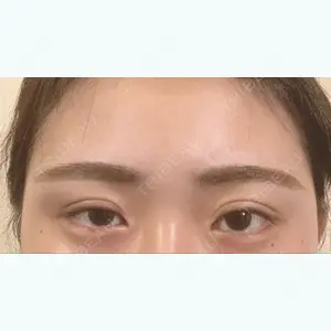 before image