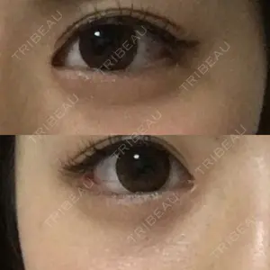 before image