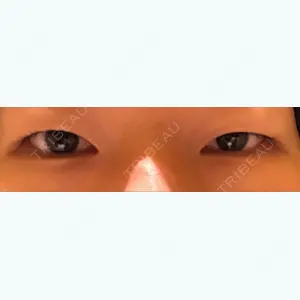 before image