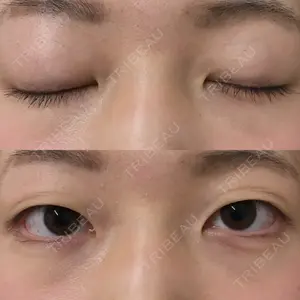 TCB東京中央美容外科 宇都宮院の永峯 祥子医師口コミ