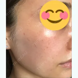 before image