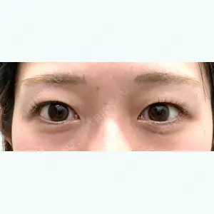 湘南美容クリニック 湘南美容クリニック 池袋東口院口コミ