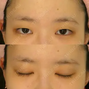 before image