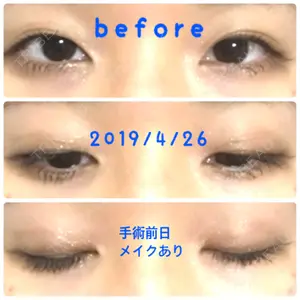 before image