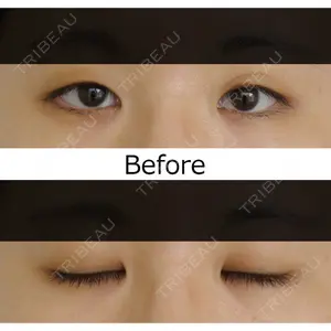 before image