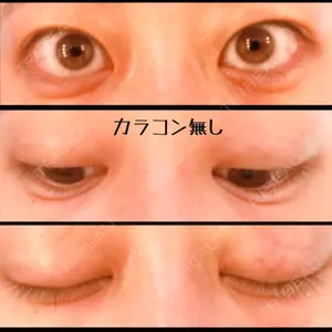 before image