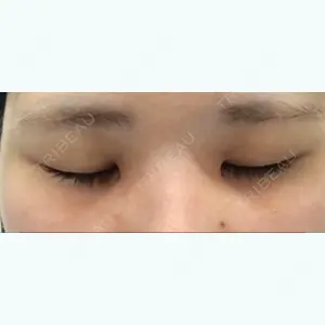before image