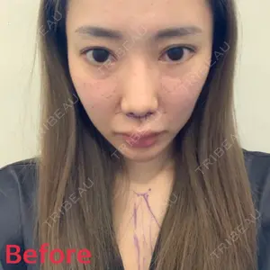 before image