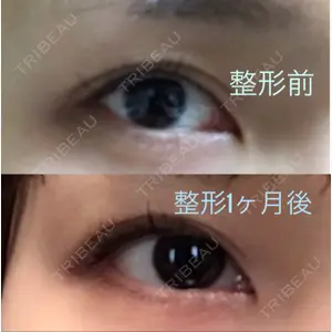 before image