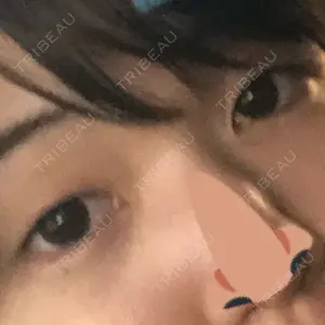 before image