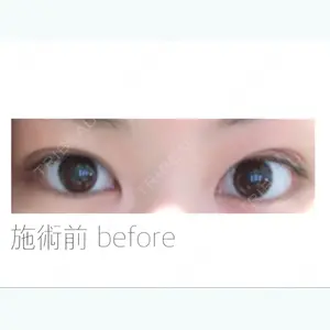 before image