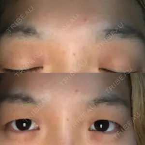 before image